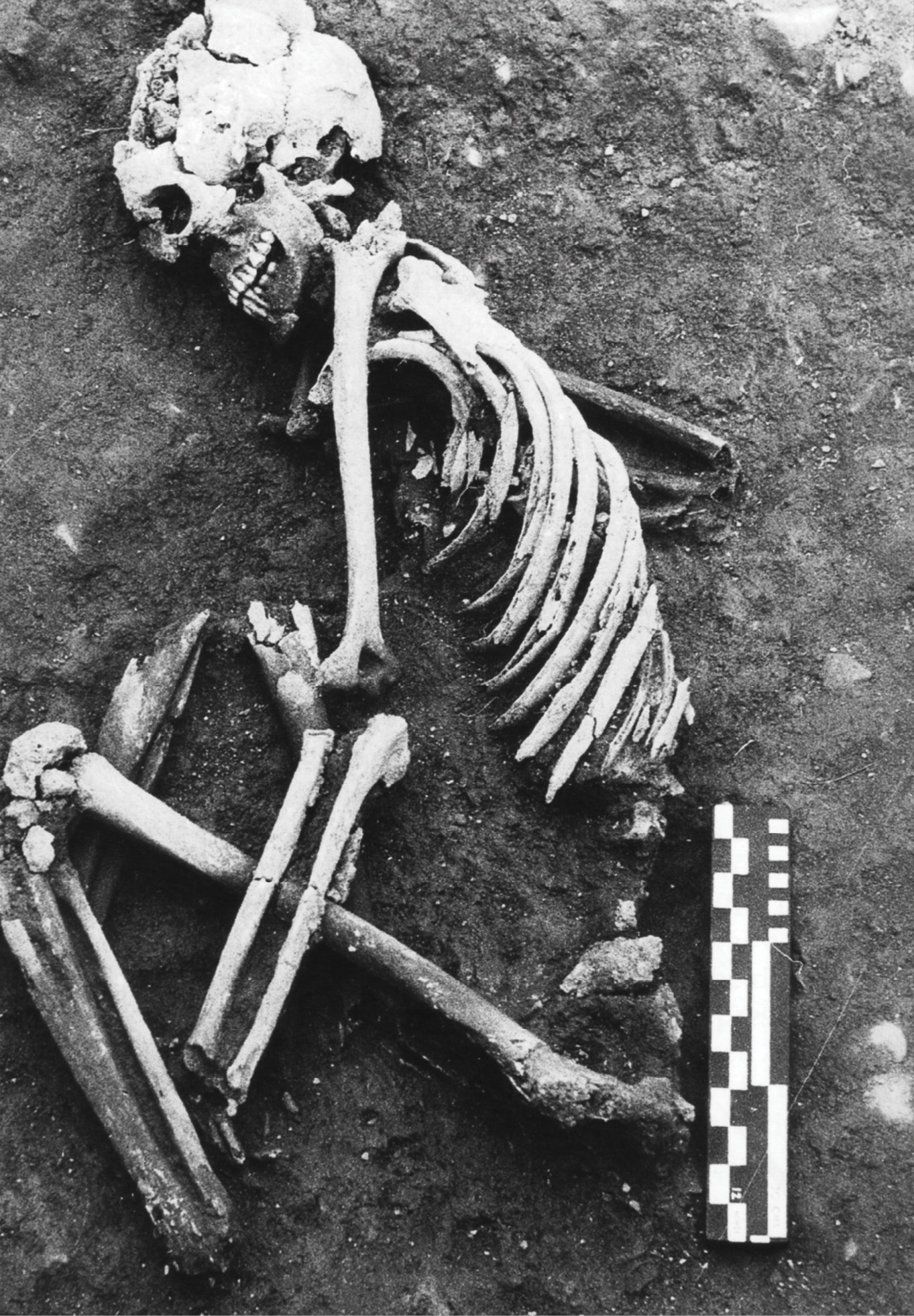 RIGHT Burial B10 is one of 14 people buried at Knowth between the 1st and 3rd centuries AD. Isotope analysis has established that some members of the group came from northern Britain. The choice of this Neolithic monument for their burial was perhaps intended to create a link between the newly arrived people and the indigenous ancestors.