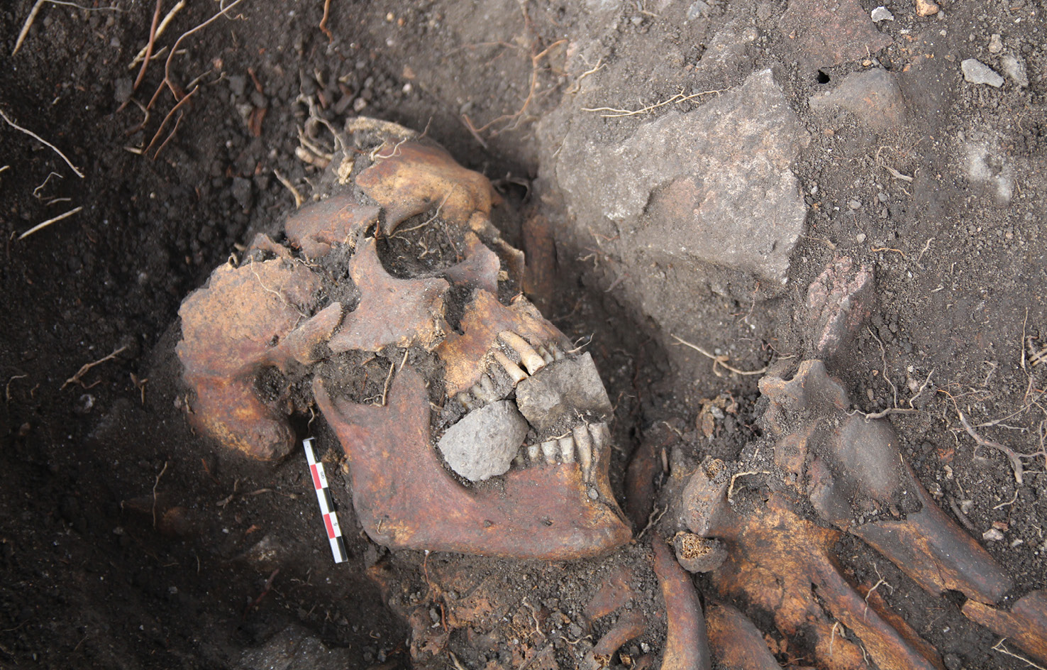 RIGHT This skeleton of a 55- to 75-year-old man dates back to the 14th century. He was buried in a shroud, with stones wedged into his mouth. Corpses that received comparable treatment are widely spread across Europe, and it is believed that the stones were intended in some way to protect against the undead.