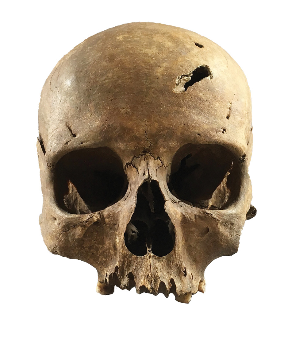 BELOW This skull belonged to a woman who was more than 60 years old, and whose life came to a brutal end in the 14th century, demonstrated by several deadly traumas.
