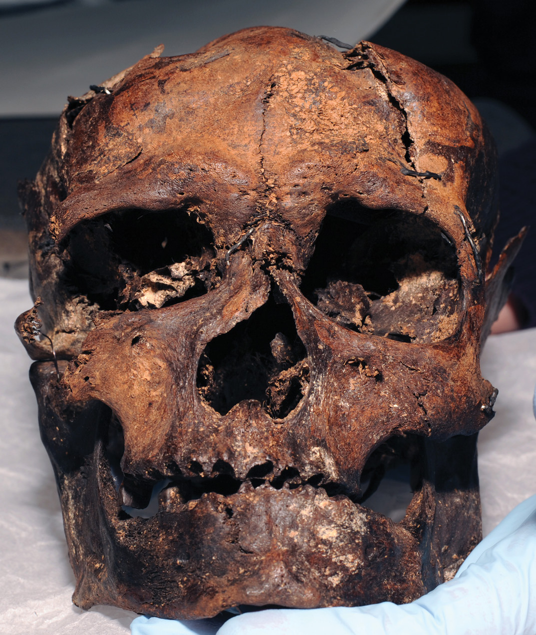 LEFT Face to face with Worsley Man, who is today held by Manchester Museum.
