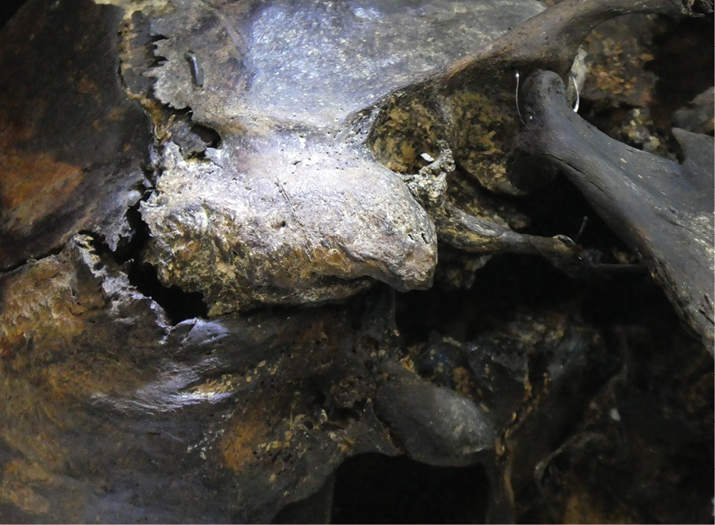 These images show the damage that a sword blow inflicted on Worsley Man’s skin (LEFT) and on the underlying bone (BELOW). The latter mark is much less severe, reminding us that skeletal remains may not always tell the full story about violence that an individual had suffered.