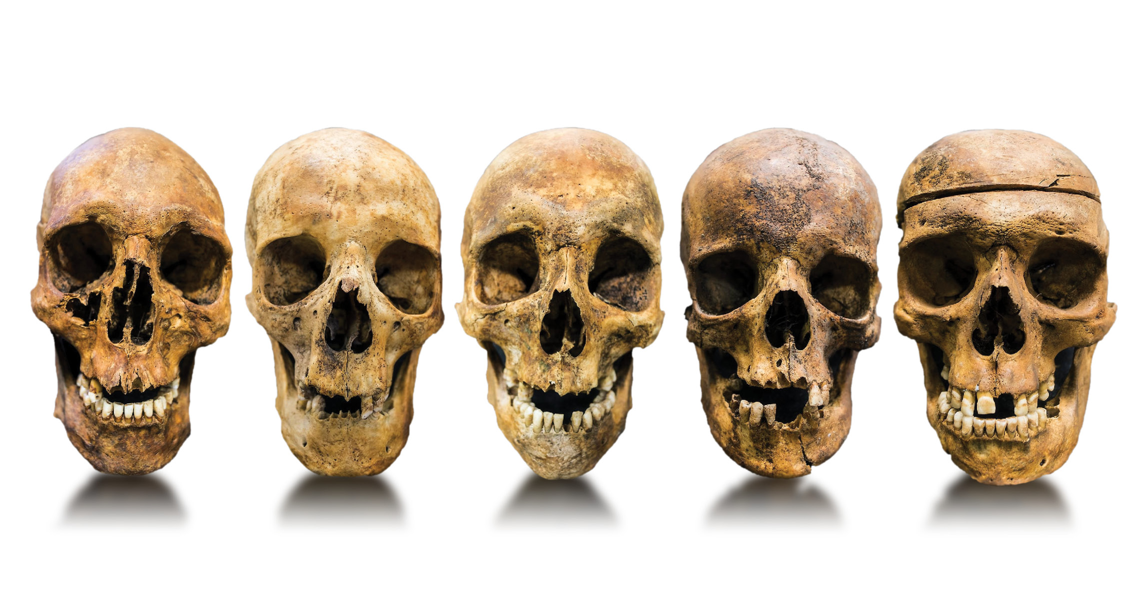 below Facing the past: skulls of five of the men whose graves were excavated by the project team. Were they prisoners of war or civilian convicts?