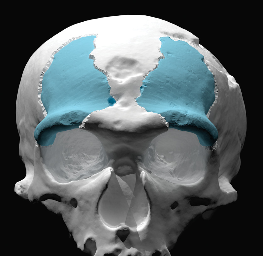 Kennis & Kennis first created a computer model based on the fragment of skull bone (LEFT), before building a clay model (CENTRE), which they used to create the final silicone replica (RIGHT).