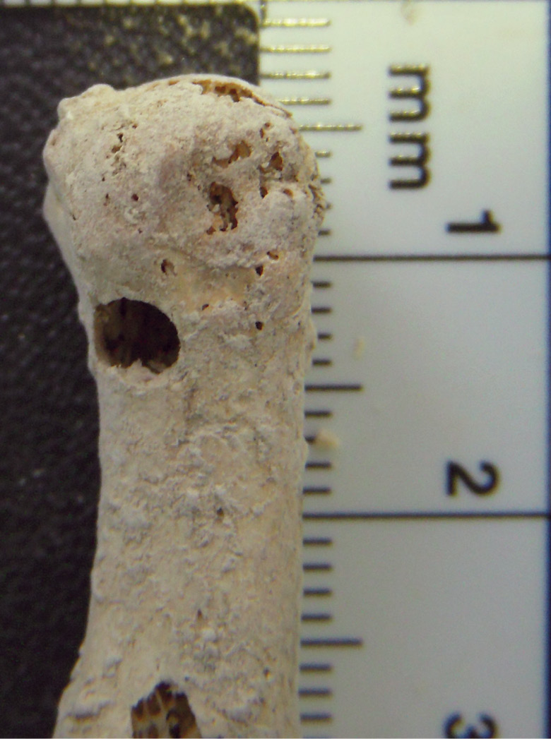 ABOVE Here a drill hole can be seen passing through the first metacarpal from the juvenile F5.