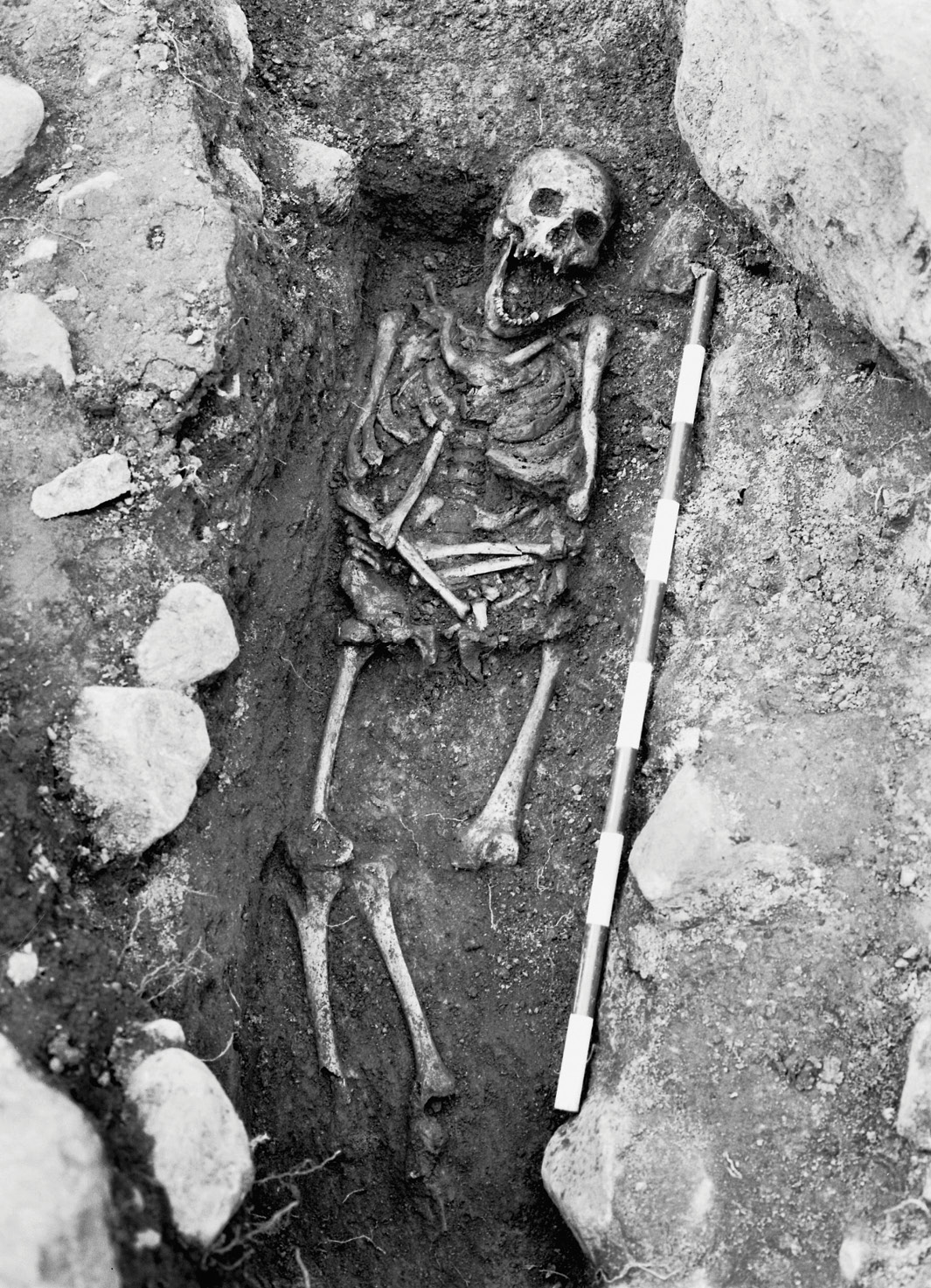 BELOW Excavations at a Viking cemetery at Tierp in 1994 revealed eight individuals in graves, one of whom appeared different to the others. Study revealed that he had a condition that causes dwarfism.