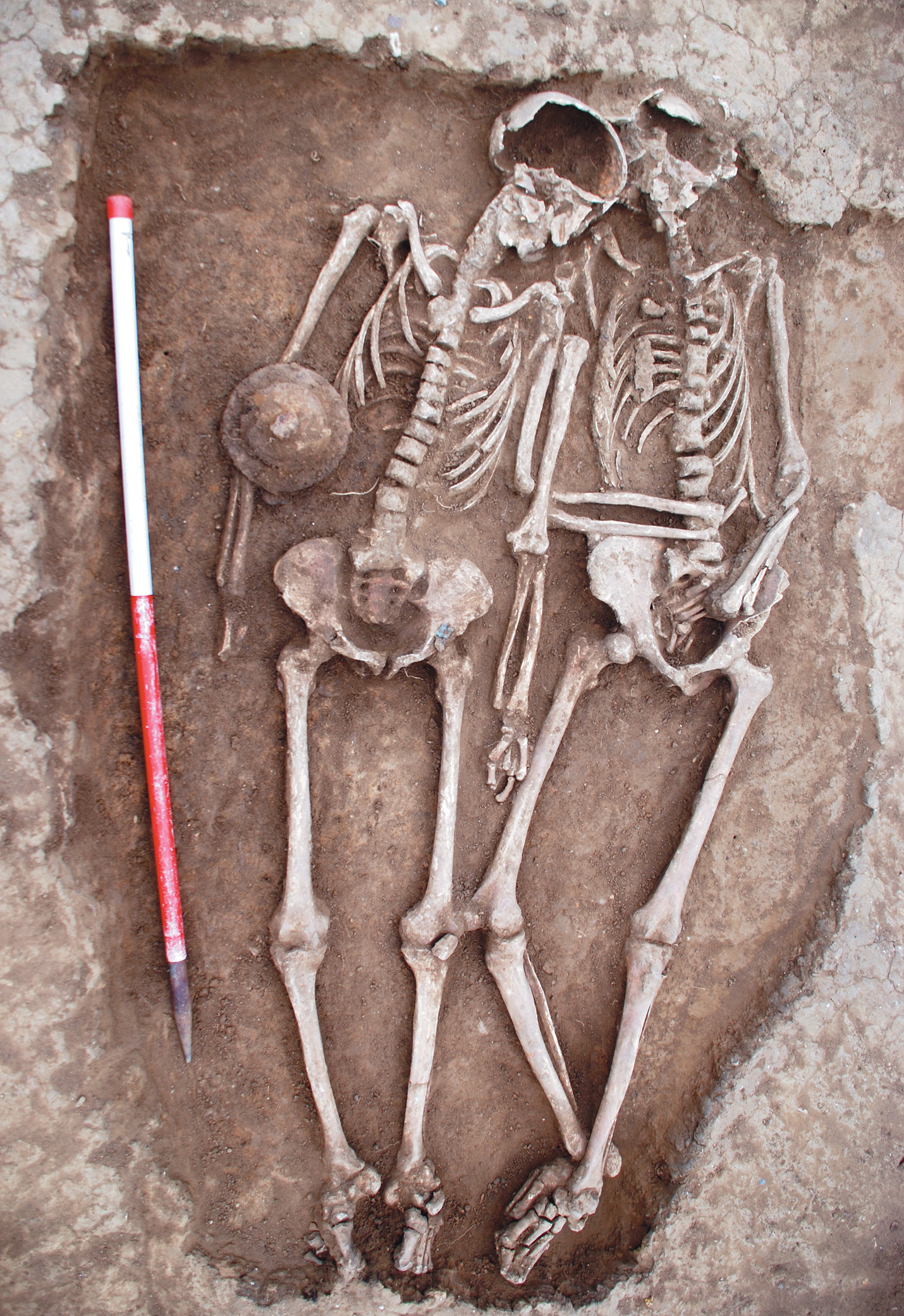 Below At Oakington’s Anglo-Saxon cemetery, in Cambridgeshire, two men were found buried with interlinked arms (Grave 88). Ancient DNA analysis has revealed no genetic relationship between the two, suggesting that, although the funeral party may have intended to signal a close personal relationship through this positioning, whatever their relationship had been in life, it was not based on biology.