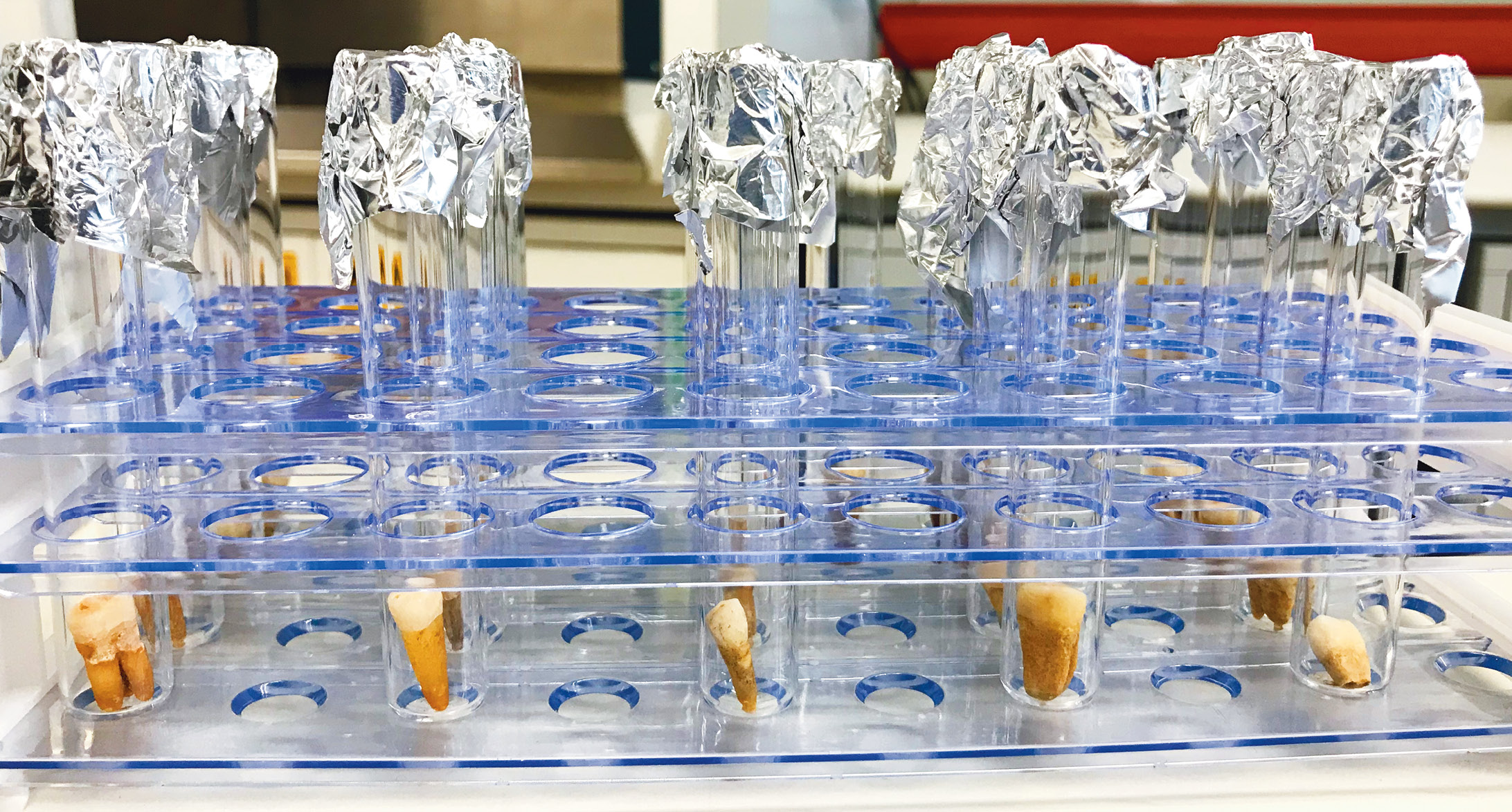 ABOVE Cleaned teeth (after having been through a sonic bath and dried in the oven) set to undergo isotope analysis.