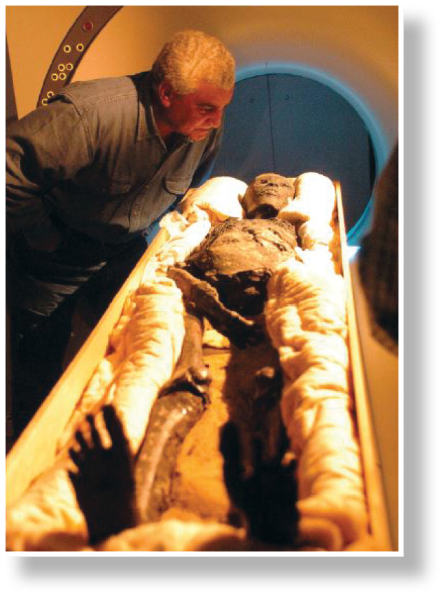 RIGHT Zahi Hawass, former general secretary of the Supreme Council of Antiquities, accompanied the mummy of Tutankhamen from its tomb (KV 62) to the Egyptian Museum’s lab in Cairo for its extensive body CT scan. BELOW Three-dimensional CT image of the head of Queen Tiye (the mummy of the Elder Lady of KV 35), showing extremely well-preserved features and hair.