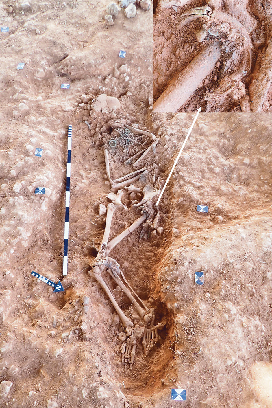 left Bag rings are typically found at the hip of the person they were buried with, suggesting they had been hung from a belt. Here, the white arrow and inset image indicate an example found with SK17, a woman laid to rest in Scremby’s early Anglo-Saxon cemetery.