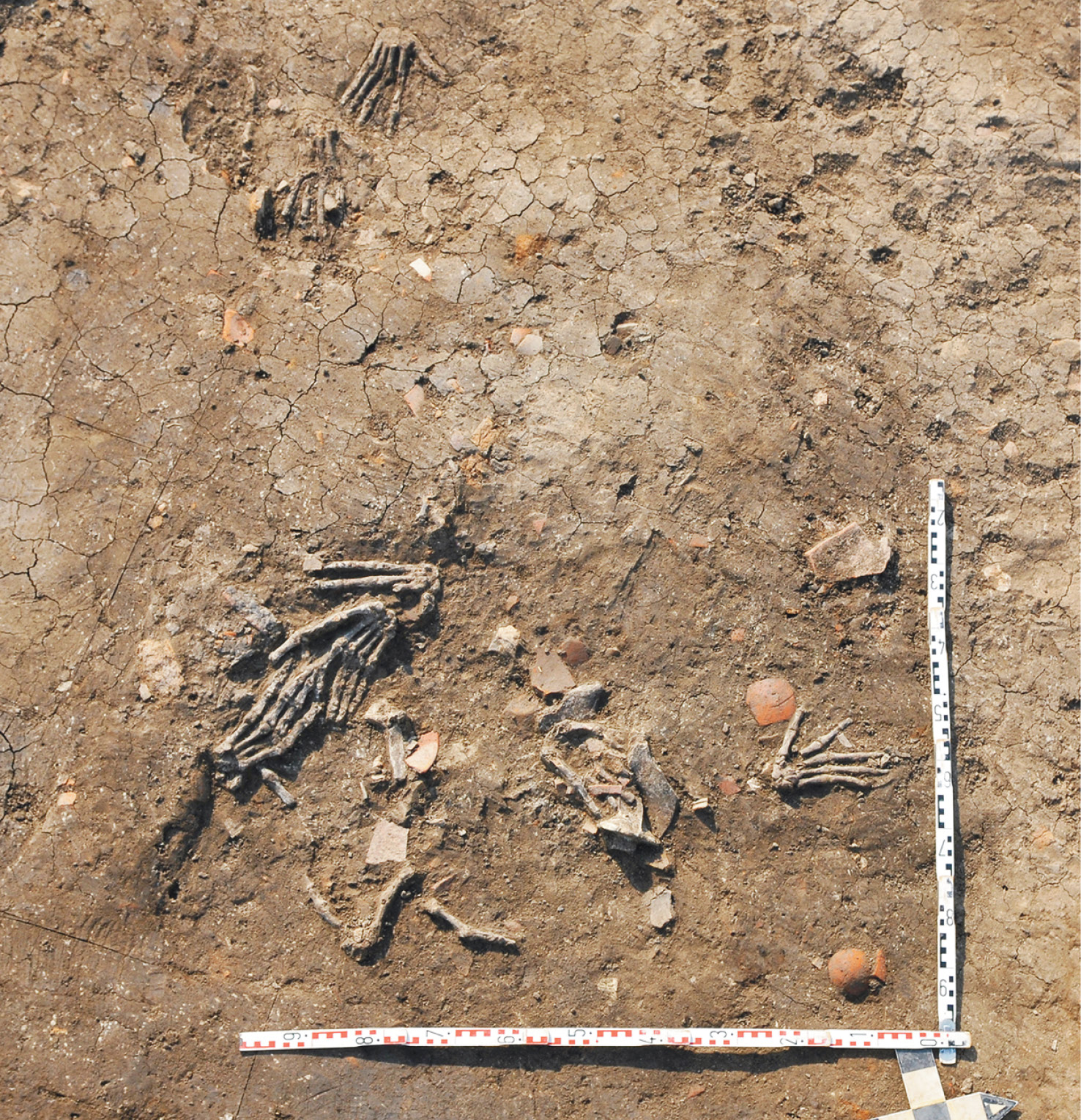 above The severed hands of at least 12 people were discovered in pits at the Hyksos palace at Tell el-Dab’a in north-eastern Egypt. below Osteological examination of the hands has determined that they were most likely carefully removed after death, supporting suggestions that they were part of a ritual ceremony.